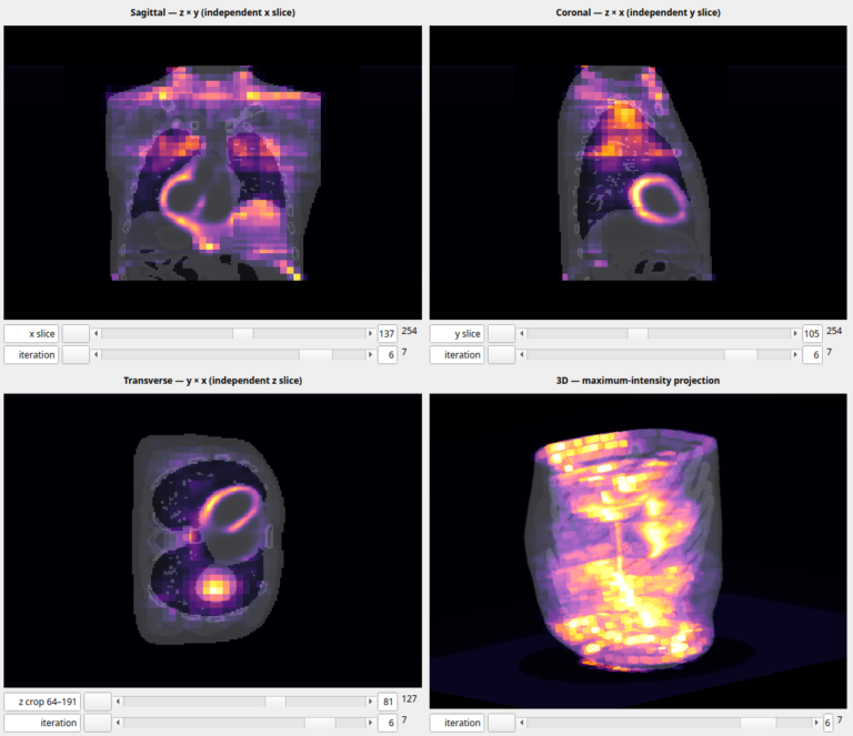 XCAT-fantomin SPECT-rekonstruktio