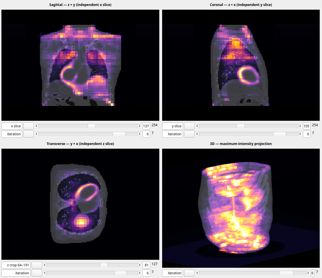 XCAT-fantomin SPECT-rekonstruktio